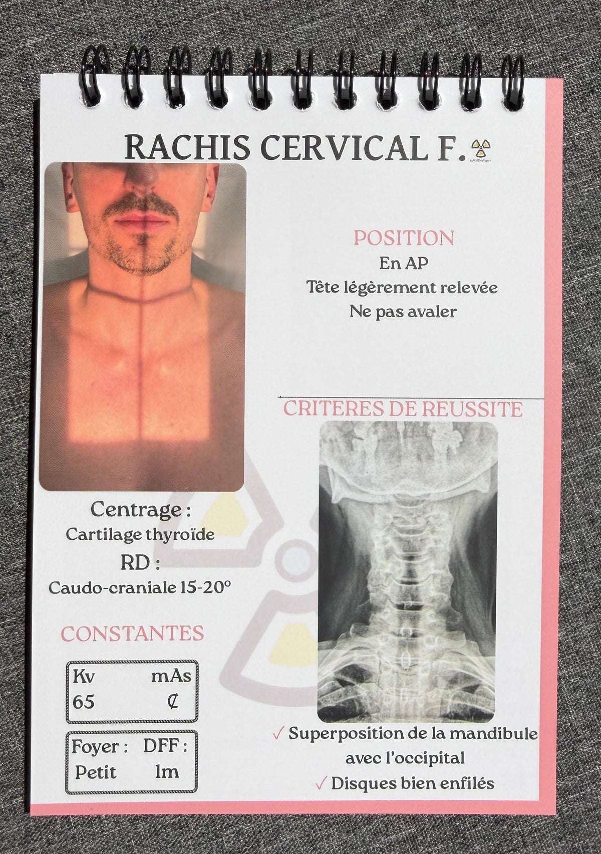 Carnet d'incidences radiologie format A6 - reliure métallique noire